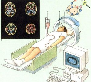 Как лежать во время позитронной эмиссионной томографии мозга